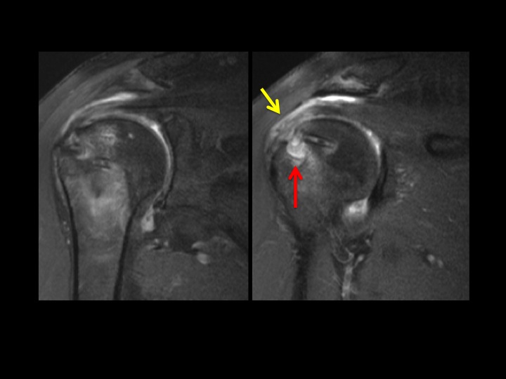 Figure 3 for case fixation device ( RID5471 )